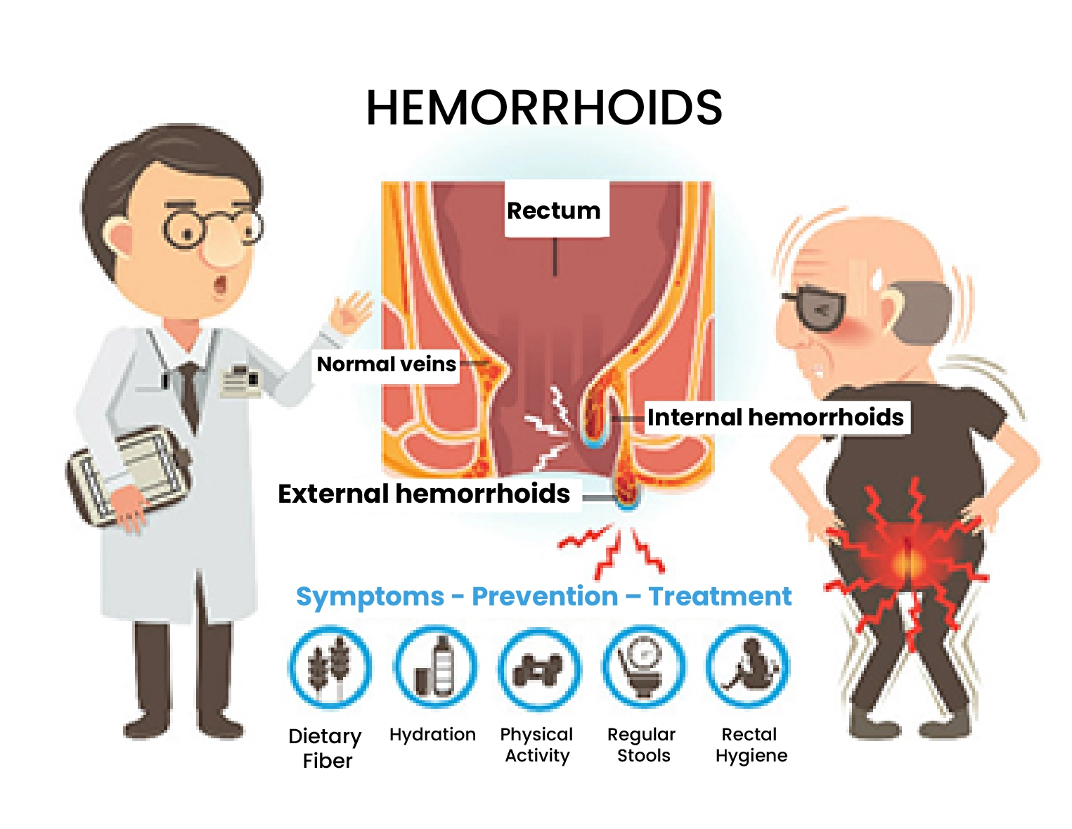 Hemorrhoids